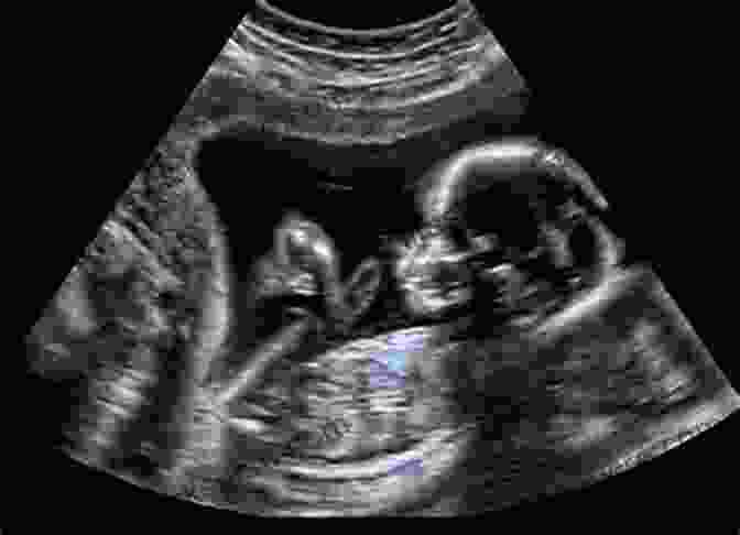 An Ultrasound Image Of A Fetus In The Womb. The Unofficial Guide To Radiology: Chest Abdominal Orthopaedic X Rays Plus CTs MRIs And Other Important Modalities (Unofficial Guides To Medicine)