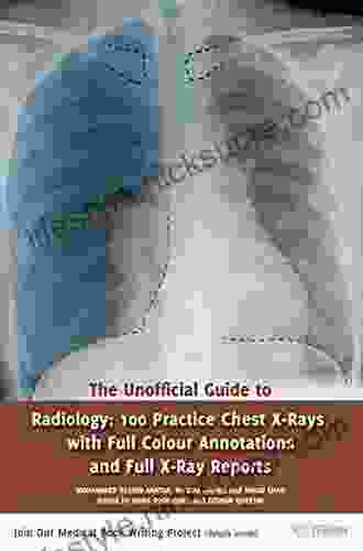 The Unofficial Guide To Radiology: 100 Practice Chest X Rays With Full Colour Annotations And Full X Ray Reports (Unofficial Guides To Medicine)